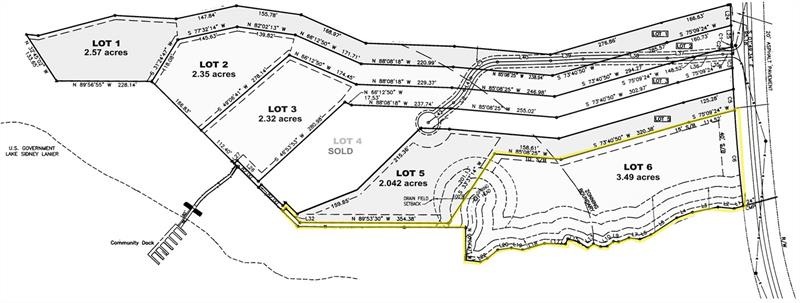 4532 Shirley Rd, Gainesville, GA 30506 - photo 1