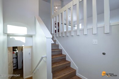 AVDP11 (3)