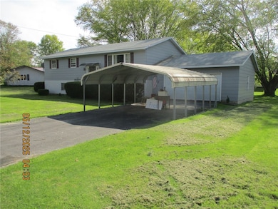 right side