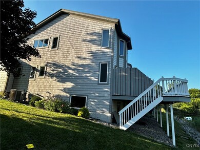 Exterior side
